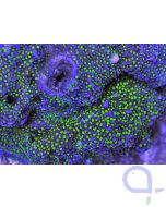 Montipora - Star Wars - Blue Green